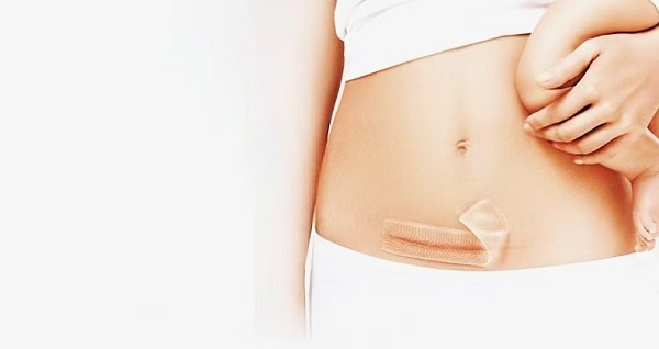 जाड सिलिकॉन जेल स्कार शीट्स इतके लोकप्रिय का आहेत?