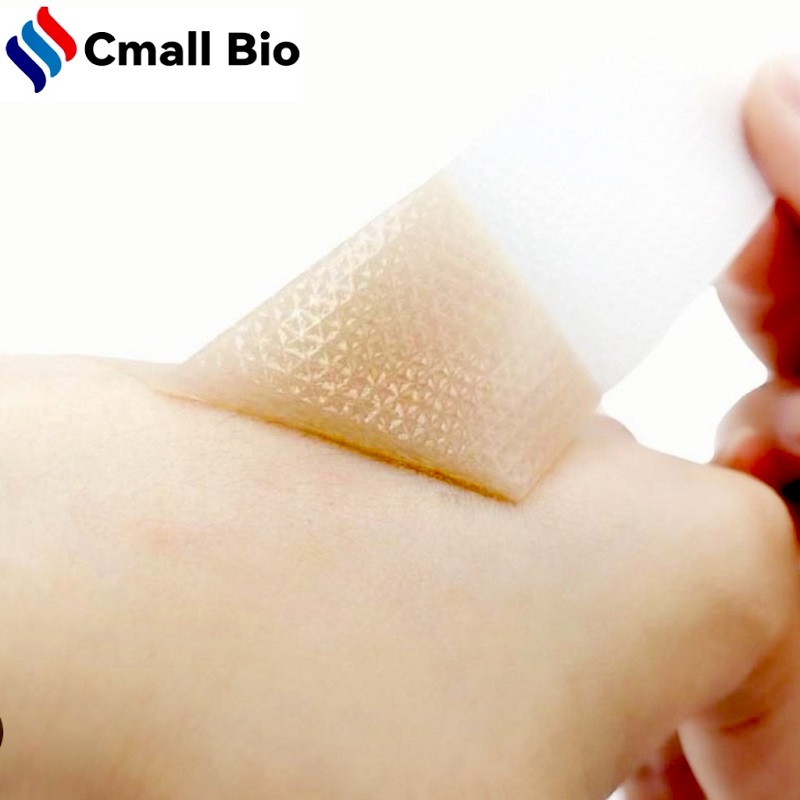 लाल आणि खाजून चट्टे बद्दल काय करावे? CmallBio सिलिकॉन जेल स्कार शीट मदत करू शकते